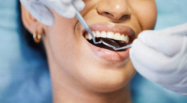 Best Emergency Wisdom Teeth Removal in Newport, SC
